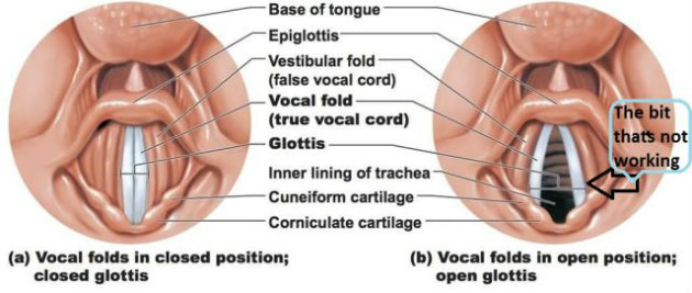 Where the voice comes from